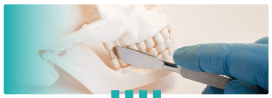 OtoPlus - Cirurgia Bucomaxilofacial em Brasília